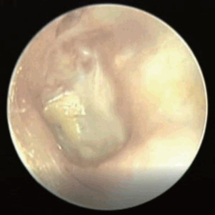 Fig. 6.