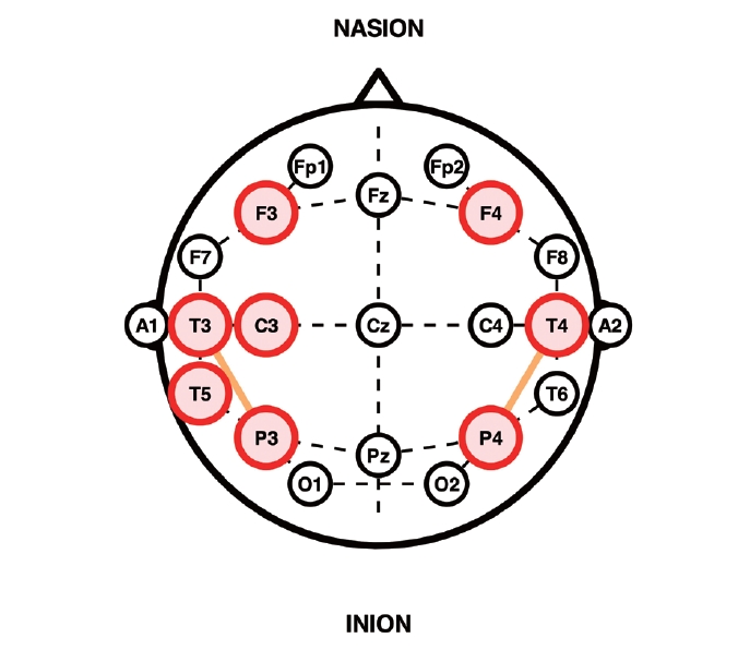 kjorl-hns-2025-00402f2.jpg